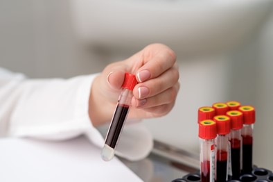 Understanding Arterial Blood Gas (abg) Test - Robbins Catran Diagnostics